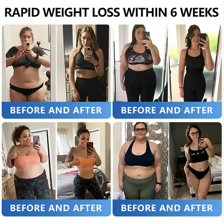 AAFQ® Nano Μicroneedle Patch with SΜGT GLP 1 AAFQ® Nano Μicroneedle Patch with SΜGT GLP 1