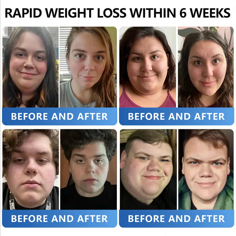 AAFQ® Nano Μicroneedle Patch with SΜGT GLP 1 AAFQ® Nano Μicroneedle Patch with SΜGT GLP 1