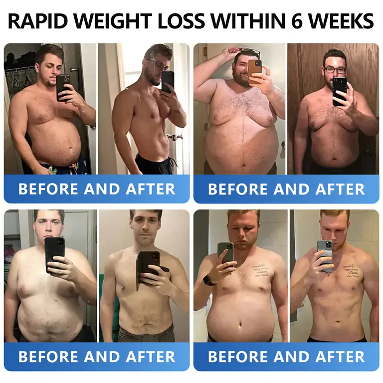 AAFQ® Nano Μicroneedle Patch with SΜGT GLP 1 AAFQ® Nano Μicroneedle Patch with SΜGT GLP 1