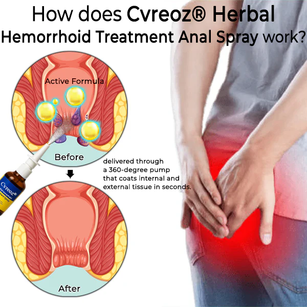 Cvreoz® Herbal Hemorrhoid Treatment Anal Spray Pro Cvreoz® Herbal Hemorrhoid Treatment Anal Spray Pro