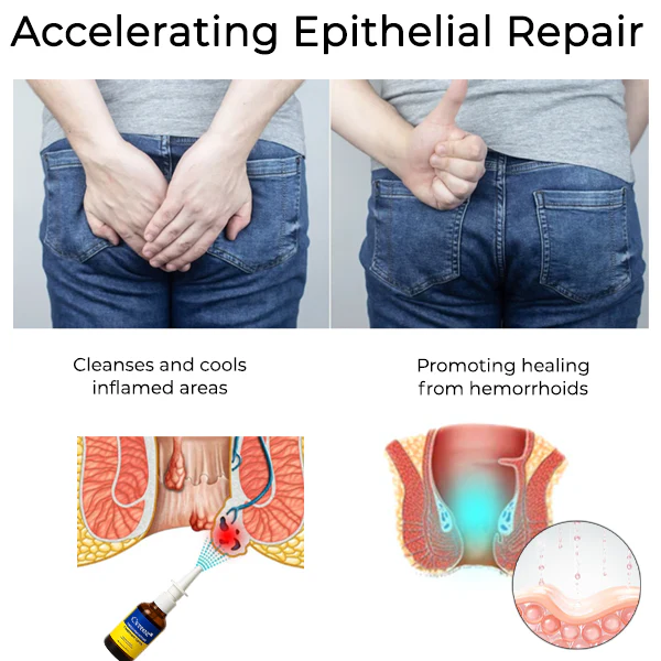 Cvreoz® Herbal Hemorrhoid Treatment Anal Spray Pro Cvreoz® Herbal Hemorrhoid Treatment Anal Spray Pro