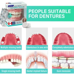 Flysmus® Suction-fit Complete Denture Flysmus® Suction-fit Complete Denture