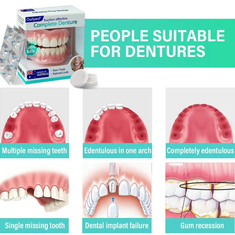Ourlyard® Suction-fit Complete Denture Ourlyard® Suction-fit Complete Denture