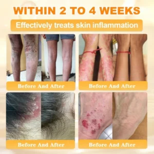 Cheemex® Bee Venom Skin Restoration Cream