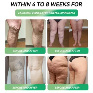 Croaie® Telportide Oral Solution Croaie® Telportide Oral Solution