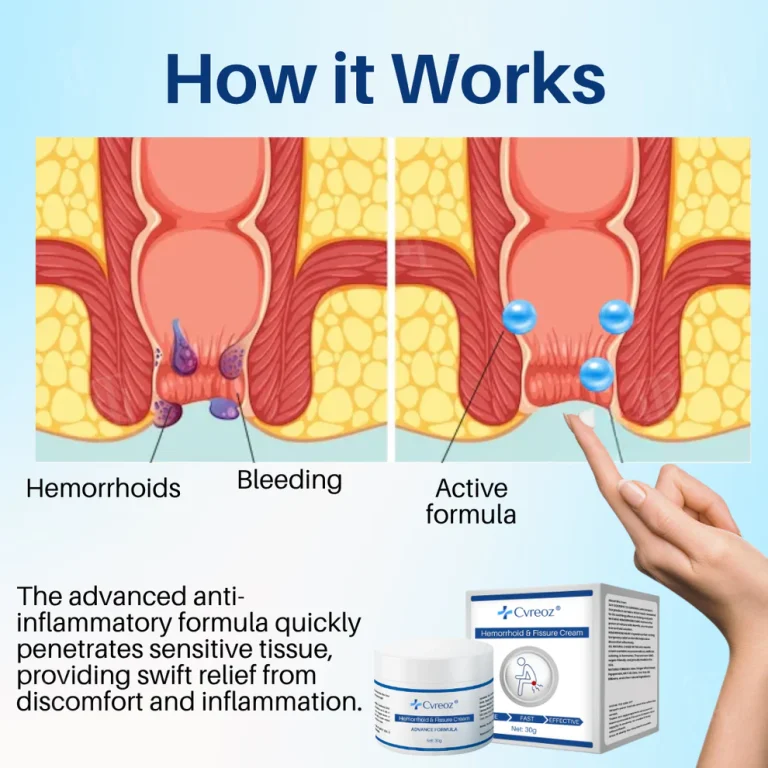 Cvreoz® Hemorrhoid & Fissure Cream Cvreoz® Hemorrhoid & Fissure Cream
